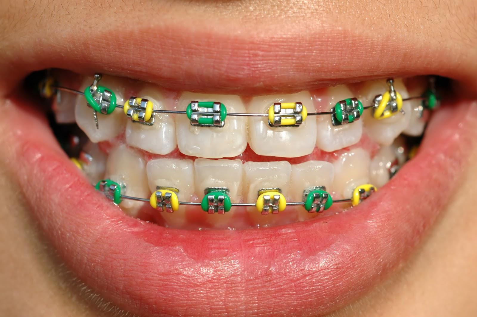 ORTHODONTİC