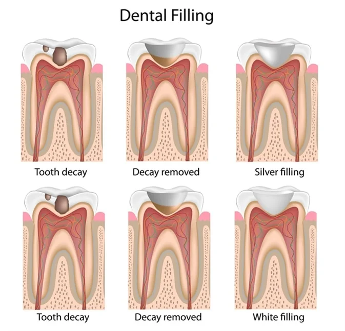 CONSERVATİVE DENTİSTRY
